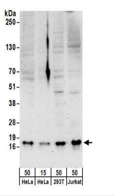 Western Blot: SNRPD3 Antibody [NBP2-22305]