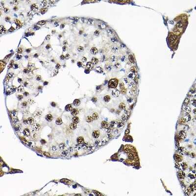 Immunohistochemistry-Paraffin: SNRPF Antibody - Azide and BSA Free [NBP2-93854]
