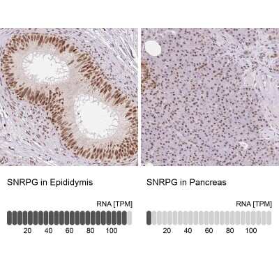 Immunohistochemistry-Paraffin: SNRPG Antibody [NBP2-38045]
