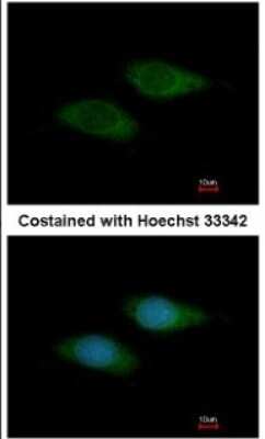 Immunocytochemistry/ Immunofluorescence: SNTB2 Antibody [NBP1-33009]