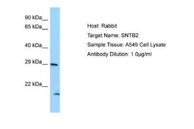 Western Blot: SNTB2 Antibody [NBP2-86815]
