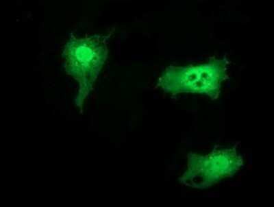 Immunocytochemistry/ Immunofluorescence: SNTG1 Antibody (OTI3G10) - Azide and BSA Free [NBP2-74261]