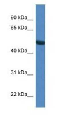 Western Blot: SNTG1 Antibody [NBP1-74119]