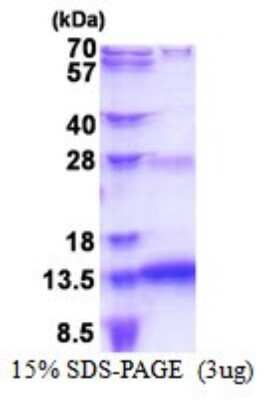 SDS-PAGE: Recombinant Human SNURF His Protein [NBP2-51544]
