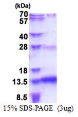 SDS-PAGE: Recombinant Human SNURF His Protein [NBP2-51544]