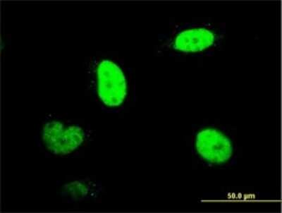 Immunocytochemistry/ Immunofluorescence: SNURPORTIN1 Antibody (2B2-1B4) [H00010073-M01]