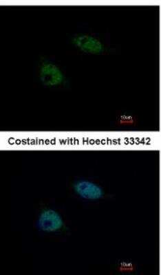 Immunocytochemistry/ Immunofluorescence: SNW1 Antibody [NBP1-31676]
