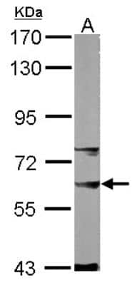 Western Blot: SNW1 Antibody [NBP1-31676]