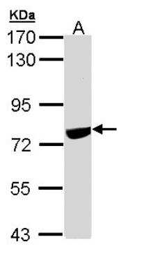 Western Blot: SNW1 Antibody [NBP1-31676]