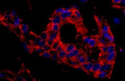 Immunohistochemistry: SNX1 Antibody [NB100-282]