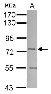 Western Blot: SNX1 Antibody [NBP2-20441]