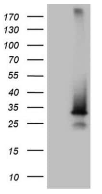 Western Blot: SNX10 Antibody (OTI6B7) [NBP2-45894]