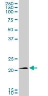 Western Blot: SNX10 Antibody [H00029887-B01P]