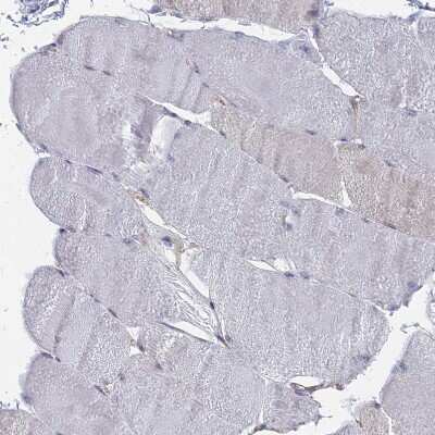 Immunohistochemistry-Paraffin: SNX11 Antibody [NBP1-85825]