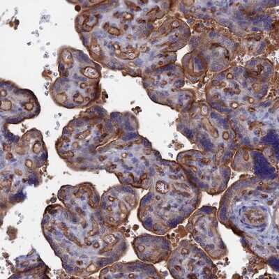 Immunohistochemistry-Paraffin: SNX11 Antibody [NBP1-85825]