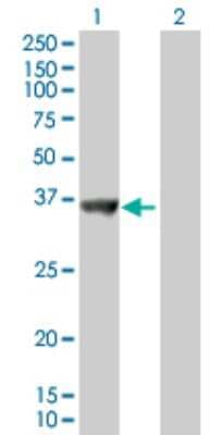 Western Blot: SNX11 Antibody [H00029916-B01P]