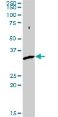 Western Blot: SNX11 Antibody [H00029916-D01P]