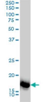 Western Blot: SNX12 Antibody (2C10) [H00029934-M01]