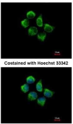 Immunocytochemistry/ Immunofluorescence: SNX12 Antibody [NBP1-31051]