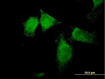 Immunocytochemistry/ Immunofluorescence: SNX13 Antibody [H00023161-B01P]