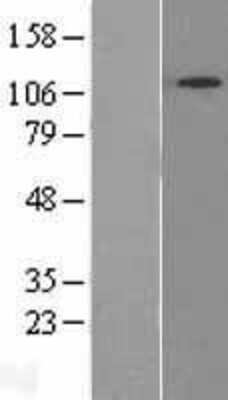 Western Blot: SNX13 Overexpression Lysate [NBL1-16304]