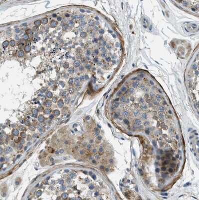 Immunohistochemistry-Paraffin: SNX14 Antibody [NBP1-80838]