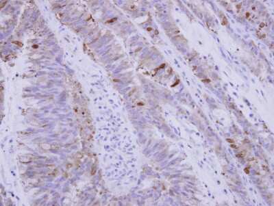Immunohistochemistry-Paraffin: SNX15 Antibody [NBP2-20442]