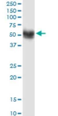 Western Blot: SNX17 Antibody (2A3) [H00009784-M01]