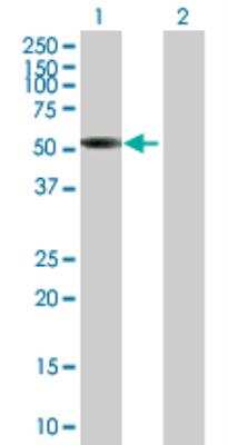 Western Blot: SNX17 Antibody [H00009784-B01P]