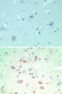 Immunohistochemistry-Paraffin: SNX2 Antibody [NBP2-24513]