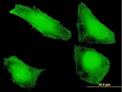 Immunocytochemistry/ Immunofluorescence: SNX20 Antibody [H00124460-B01P]