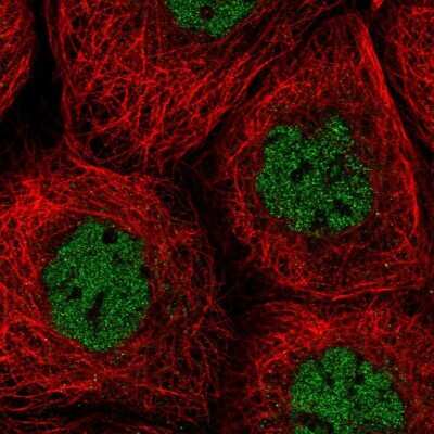 Immunocytochemistry/ Immunofluorescence: SNX20 Antibody [NBP1-92418]