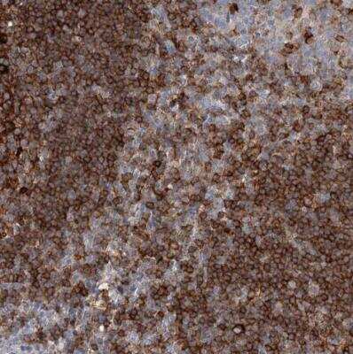 Immunohistochemistry-Paraffin: SNX22 Antibody [NBP1-82244]