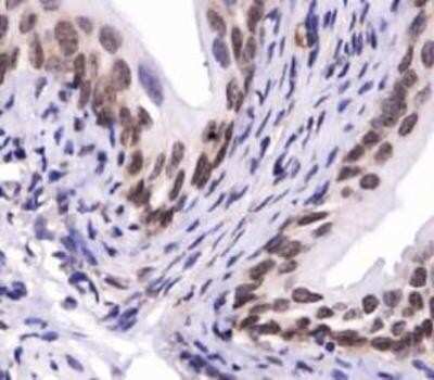 Immunohistochemistry: SNX27 Antibody - BSA Free [NBP1-45283]