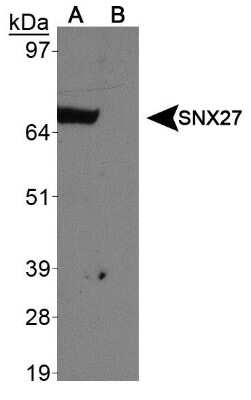 Western Blot: SNX27 AntibodyBSA Free [NBP1-45283]