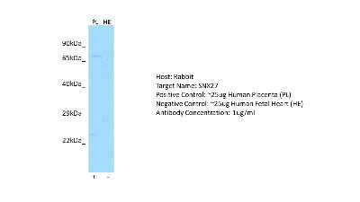 Western Blot: SNX27 Antibody [NBP2-86817]