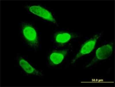 Immunocytochemistry/ Immunofluorescence: SNX29 Antibody (6D6) [H00084127-M02]