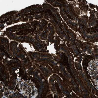 Immunohistochemistry-Paraffin: SNX30 Antibody [NBP1-90841]