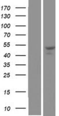 Western Blot: SNX30 Overexpression Lysate [NBP2-08716]