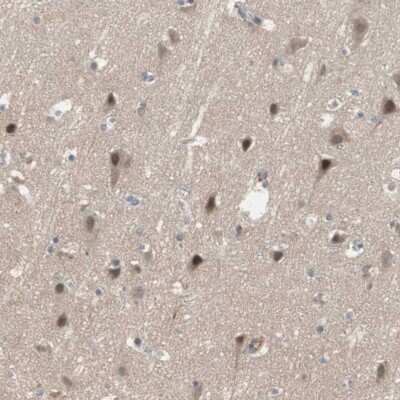 Immunohistochemistry-Paraffin: SNX4 Antibody [NBP1-88882]