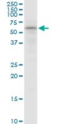 Western Blot: SNX4 Antibody [H00008723-B01P]