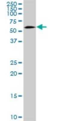 Western Blot: SNX4 Antibody [H00008723-B01P]