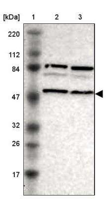 Western Blot: SNX4 Antibody [NBP1-88882]