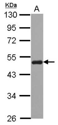 Western Blot: SNX5 Antibody [NBP2-20448]