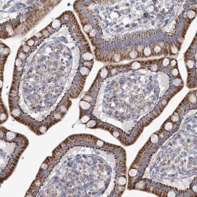 Immunohistochemistry-Paraffin: SNX7 Antibody [NBP1-86276]