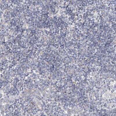Immunohistochemistry-Paraffin: SNX7 Antibody [NBP1-86276]