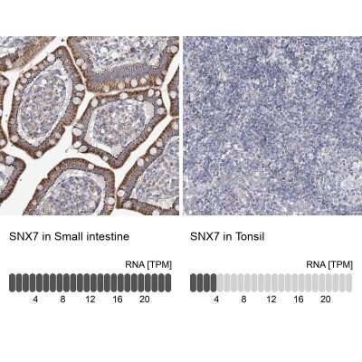Immunohistochemistry-Paraffin: SNX7 Antibody [NBP1-86276]