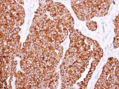 Immunohistochemistry-Paraffin: SNX7 Antibody [NBP2-20450]
