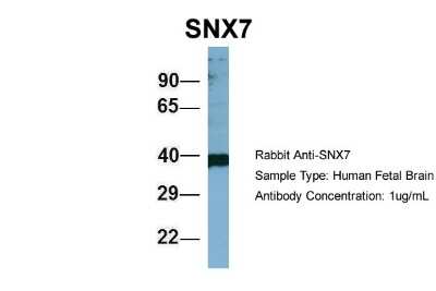 Western Blot: SNX7 Antibody [NBP1-58862]