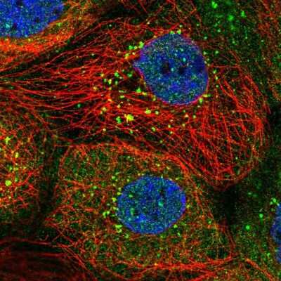 Immunocytochemistry/ Immunofluorescence: SNX8 Antibody [NBP2-31672]